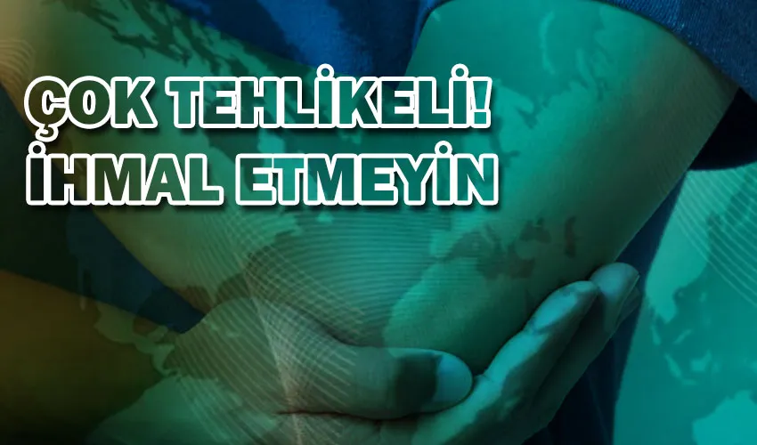 DİRSEK AĞRISI NEDENLERİNE DİKKAT !